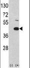 MOS Proto-Oncogene, Serine/Threonine Kinase antibody, PA5-15332, Invitrogen Antibodies, Western Blot image 