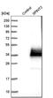 Serine Peptidase Inhibitor, Kunitz Type 2 antibody, NBP1-83299, Novus Biologicals, Western Blot image 
