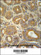 Cellular Retinoic Acid Binding Protein 1 antibody, 61-922, ProSci, Immunohistochemistry paraffin image 