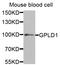 Glycosylphosphatidylinositol Specific Phospholipase D1 antibody, LS-C334829, Lifespan Biosciences, Western Blot image 