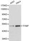 Thymidine Phosphorylase antibody, LS-C192367, Lifespan Biosciences, Western Blot image 