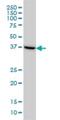 Guided Entry Of Tail-Anchored Proteins Factor 3, ATPase antibody, H00000439-M03, Novus Biologicals, Western Blot image 