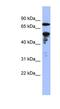 Zinc Finger Protein 549 antibody, NBP1-80425, Novus Biologicals, Western Blot image 