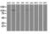 BUB1 Mitotic Checkpoint Serine/Threonine Kinase B antibody, GTX84771, GeneTex, Western Blot image 