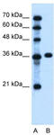 Patched 1 antibody, TA334665, Origene, Western Blot image 