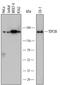 DNA Topoisomerase II Beta antibody, MAB6348, R&D Systems, Western Blot image 