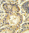 Suppressor Of Cytokine Signaling 1 antibody, LS-C161380, Lifespan Biosciences, Immunohistochemistry paraffin image 