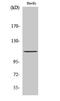 RB Transcriptional Corepressor 1 antibody, A00039S807-1, Boster Biological Technology, Western Blot image 