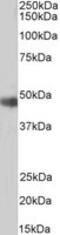 Origin Recognition Complex Subunit 4 antibody, MBS420790, MyBioSource, Western Blot image 