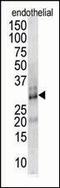 Regulator Of Calcineurin 1 antibody, LS-C100067, Lifespan Biosciences, Western Blot image 