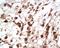 Solute Carrier Family 2 Member 2 antibody, GTX37686, GeneTex, Immunohistochemistry paraffin image 