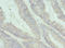 Interleukin 17B antibody, LS-C675889, Lifespan Biosciences, Immunohistochemistry paraffin image 