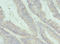 Interleukin-17B antibody, LS-C675889, Lifespan Biosciences, Immunohistochemistry paraffin image 