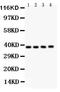PIN2 (TERF1) Interacting Telomerase Inhibitor 1 antibody, PB9498, Boster Biological Technology, Western Blot image 