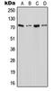 Solute Carrier Family 6 Member 18 antibody, LS-C353421, Lifespan Biosciences, Western Blot image 