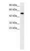 Nuclear Receptor Subfamily 5 Group A Member 1 antibody, PA1-30599, Invitrogen Antibodies, Western Blot image 