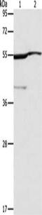 Aldehyde Dehydrogenase 3 Family Member A1 antibody, CSB-PA951869, Cusabio, Western Blot image 