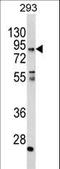 Coiled-Coil Alpha-Helical Rod Protein 1 antibody, LS-C168447, Lifespan Biosciences, Western Blot image 