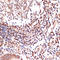 Arachidonate 5-Lipoxygenase antibody, GTX02838, GeneTex, Immunohistochemistry paraffin image 