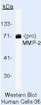 Matrix Metallopeptidase 2 antibody, MA5-14186, Invitrogen Antibodies, Western Blot image 