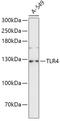 Toll Like Receptor 4 antibody, A00017S441, Boster Biological Technology, Western Blot image 