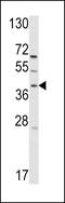 G Protein-Coupled Receptor Class C Group 5 Member A antibody, LS-C100486, Lifespan Biosciences, Western Blot image 