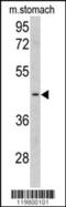 Clusterin-associated protein 1 antibody, 62-369, ProSci, Western Blot image 