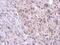 Tetratricopeptide Repeat Domain 39B antibody, NBP2-15148, Novus Biologicals, Immunohistochemistry paraffin image 