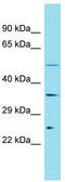 Family With Sequence Similarity 166 Member A antibody, TA336200, Origene, Western Blot image 