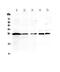 Interleukin-36 alpha antibody, A09802-1, Boster Biological Technology, Western Blot image 