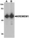 Kringle Containing Transmembrane Protein 1 antibody, LS-B10086, Lifespan Biosciences, Western Blot image 