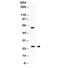 RAB11A, Member RAS Oncogene Family antibody, R32159, NSJ Bioreagents, Western Blot image 