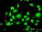 Mitogen-Activated Protein Kinase 1 antibody, LS-C197993, Lifespan Biosciences, Immunofluorescence image 