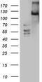 Serine/threonine-protein kinase LATS2 antibody, M01352, Boster Biological Technology, Western Blot image 