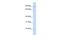 Zinc Finger Protein 408 antibody, A08774, Boster Biological Technology, Western Blot image 