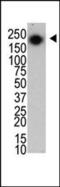 Leucine Rich Repeat Kinase 2 antibody, MA5-11155, Invitrogen Antibodies, Western Blot image 