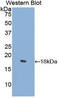 Collagen Type II Alpha 1 Chain antibody, LS-C293426, Lifespan Biosciences, Western Blot image 