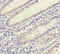 Ornithine Carbamoyltransferase antibody, A57433-100, Epigentek, Immunohistochemistry paraffin image 