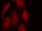 Cyclin Dependent Kinase 6 antibody, A00358-1, Boster Biological Technology, Immunofluorescence image 