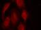 Cyclin Dependent Kinase 6 antibody, A00358-1, Boster Biological Technology, Immunofluorescence image 