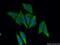 SET And MYND Domain Containing 4 antibody, 17594-1-AP, Proteintech Group, Immunofluorescence image 