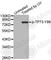 Tumor Protein P73 antibody, AP0465, ABclonal Technology, Western Blot image 