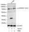 Mitogen-Activated Protein Kinase Kinase Kinase 7 antibody, A01458S412, Boster Biological Technology, Western Blot image 