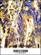 AXL Receptor Tyrosine Kinase antibody, 63-031, ProSci, Immunohistochemistry paraffin image 