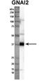 G Protein Subunit Alpha I2 antibody, TA335038, Origene, Western Blot image 