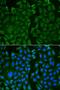 Transketolase antibody, orb247362, Biorbyt, Immunofluorescence image 