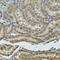 Programmed Cell Death 6 Interacting Protein antibody, LS-C331993, Lifespan Biosciences, Immunohistochemistry frozen image 