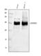 ERBB2 antibody, A00010-2, Boster Biological Technology, Western Blot image 