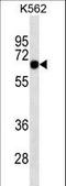 SRY-Box 9 antibody, LS-C161405, Lifespan Biosciences, Western Blot image 