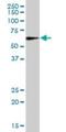 Monoamine Oxidase A antibody, H00004128-B02P, Novus Biologicals, Western Blot image 